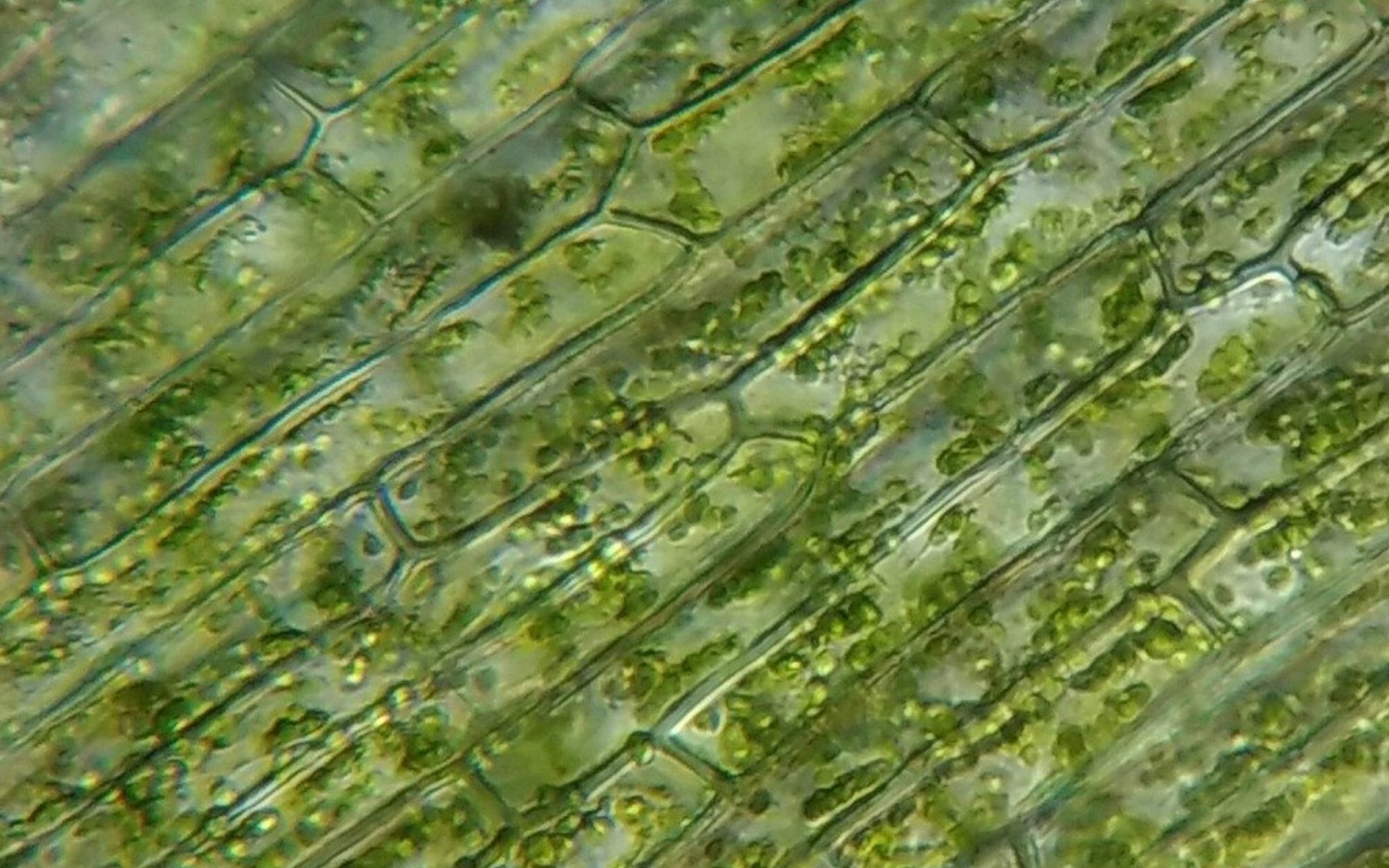 Хлоропласты в клетках листьев крупные. Лист элодеи канадской под микроскопом. Хлоропласт микрофотография. Клетка элодеи под микроскопом. Хлоропласты элодеи.